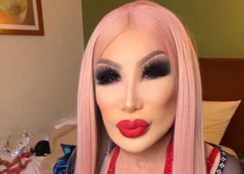 Lin May invita a sus fans a ponerse botox y lucir “radiantes” como ella.