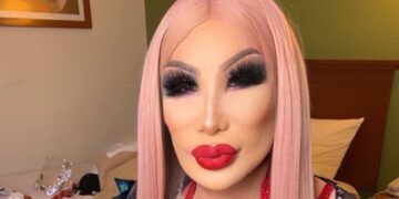 Lin May invita a sus fans a ponerse botox y lucir “radiantes” como ella.