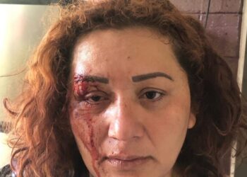 Capturan a sujeto que vapuleo a esposa.