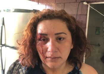 Hombre golpea brutalmente a su esposa y la amenaza para que no lo denuncie.
