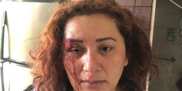 Hombre golpea brutalmente a su esposa y la amenaza para que no lo denuncie.