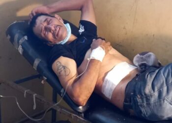 Lesionan a sujeto en supuesto intercambio de disparos con la PNC.