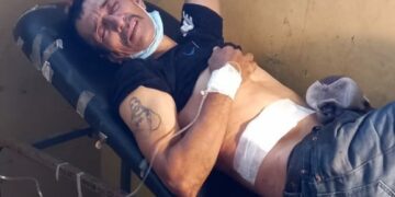 Lesionan a sujeto en supuesto intercambio de disparos con la PNC.