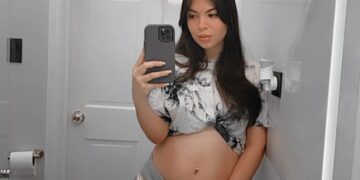 “Casi pierdo la vida” Yessica Cárcamo.