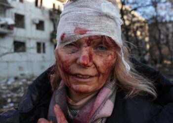57 muertos y decenas de heridos, tras el ataque de Rusia a Ucrania.