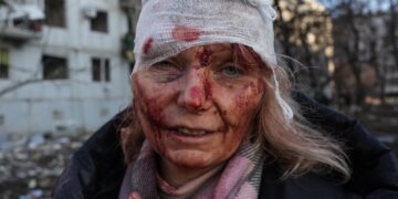 57 muertos y decenas de heridos, tras el ataque de Rusia a Ucrania.