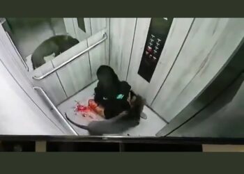 Pitbull ataca brutalmente a mujer.