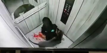 Pitbull ataca brutalmente a mujer.
