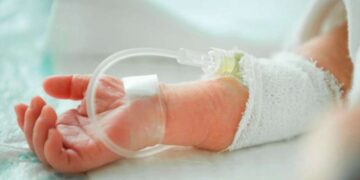 Muere el primer niño por la nueva hepatitis aguda.