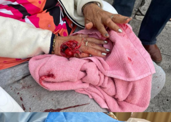 Perro ataca brutalmente a anciana en San Salvador.