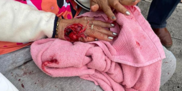 Perro ataca brutalmente a anciana en San Salvador.