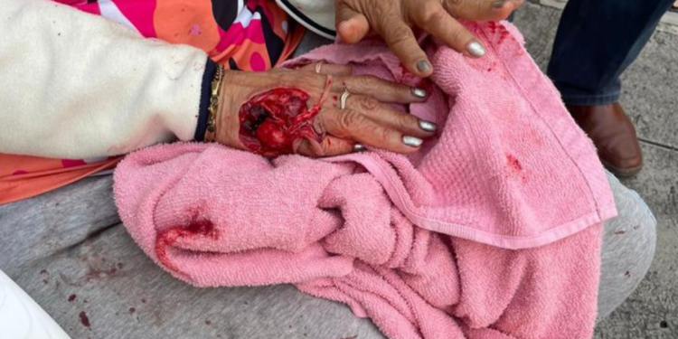 Perro ataca brutalmente a anciana en San Salvador.