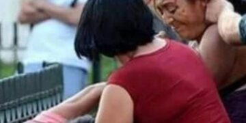 “Fui a tomar con alguien, llegó el marido de ella y le pegó, pues por eso me los soné”. Yanira Berríos.