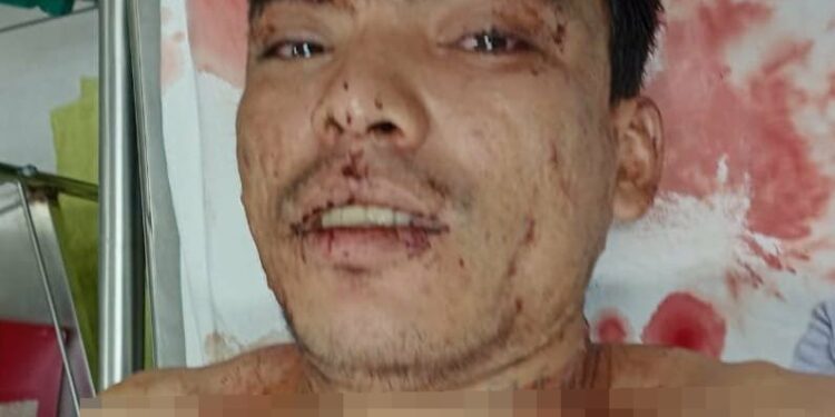 Apuñalan a terrorista en Ahuachapán.