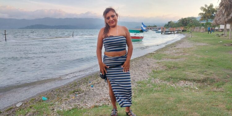 “Los ricos son mis besos”. Asegura la tiktoker, Yanira Berríos.