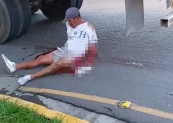 Hombre pierde brazo tras ser impactado por rastra en San Miguel.