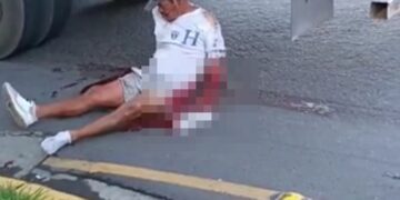 Hombre pierde brazo tras ser impactado por rastra en San Miguel.
