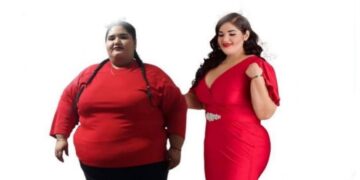 Influencer fallece tras someterse a cirugía para bajar de peso.