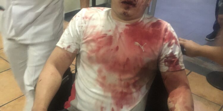 Joven fue vapuleado en prestigiosa residencial de La Libertad.