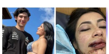 Modelo fue vapuleada por su novio.