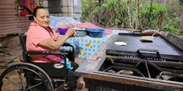 Mujer amputada vende pupusas para comprar prótesis.