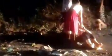 Joven quedó amputada tras accidente en Morazán.